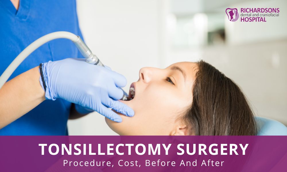 tonsillectomy Surgery procedure