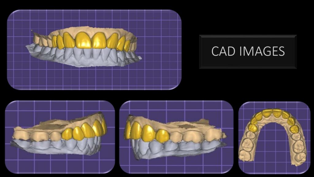 CAD images
