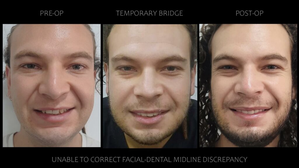 facial dental midline