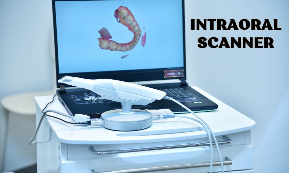 intraoral scanner