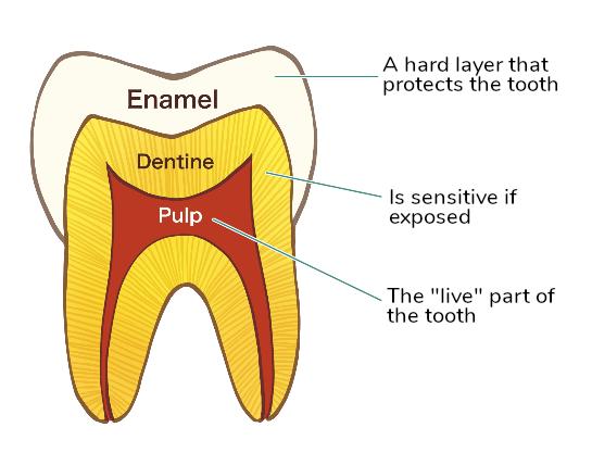 root canal treatment option