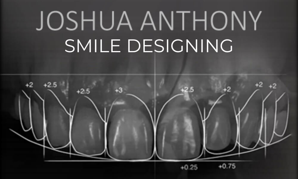 smile designing surgery