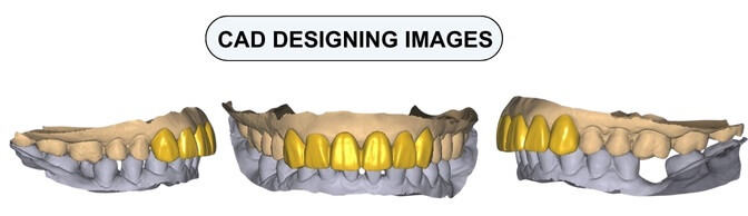 dental cad images